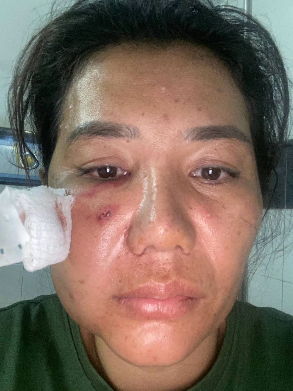 磅清扬省发生枪击事件 一名女性面部中弹受重伤
