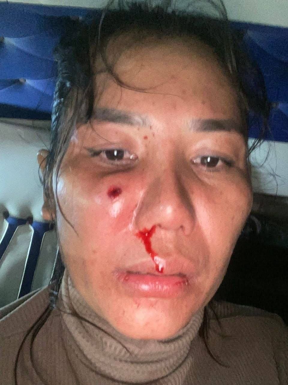 磅通省警方抓获射伤妇女嫌疑人
