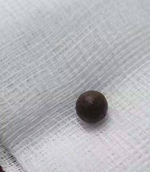磅通省警方抓获射伤妇女嫌疑人