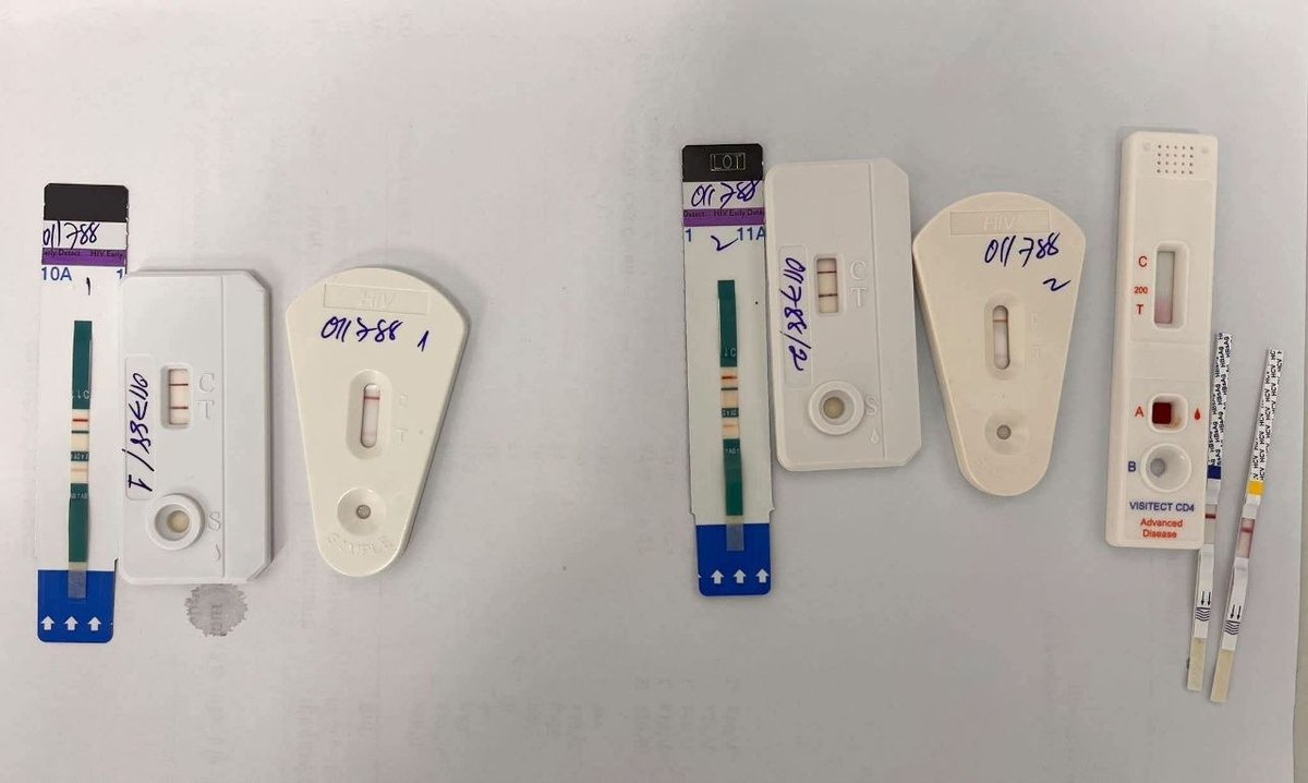 公立医院发现青少年HIV感染病例 呼吁加强健康教育