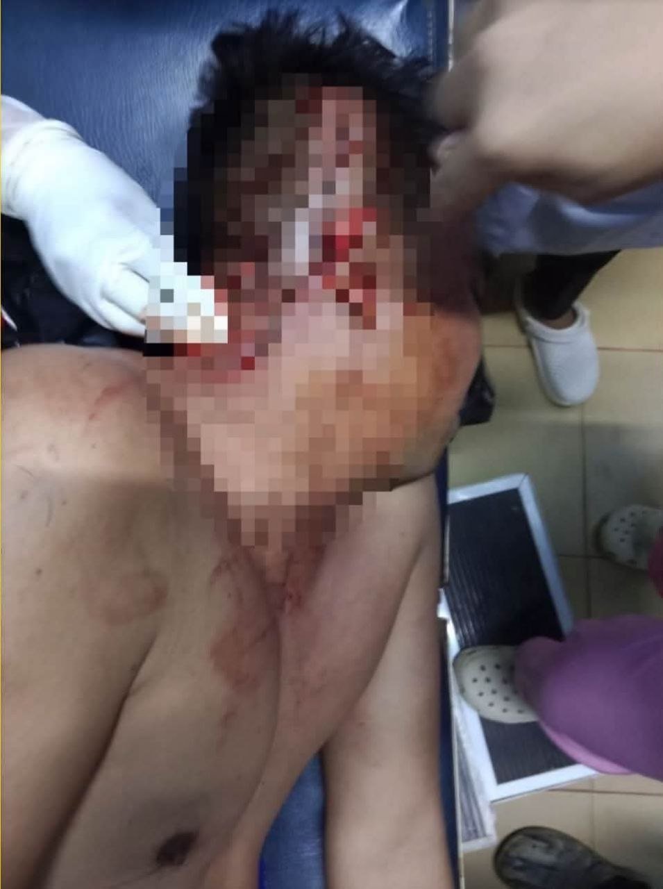 柏威夏省宪兵指挥官遭砍伤 嫌疑人已被捕