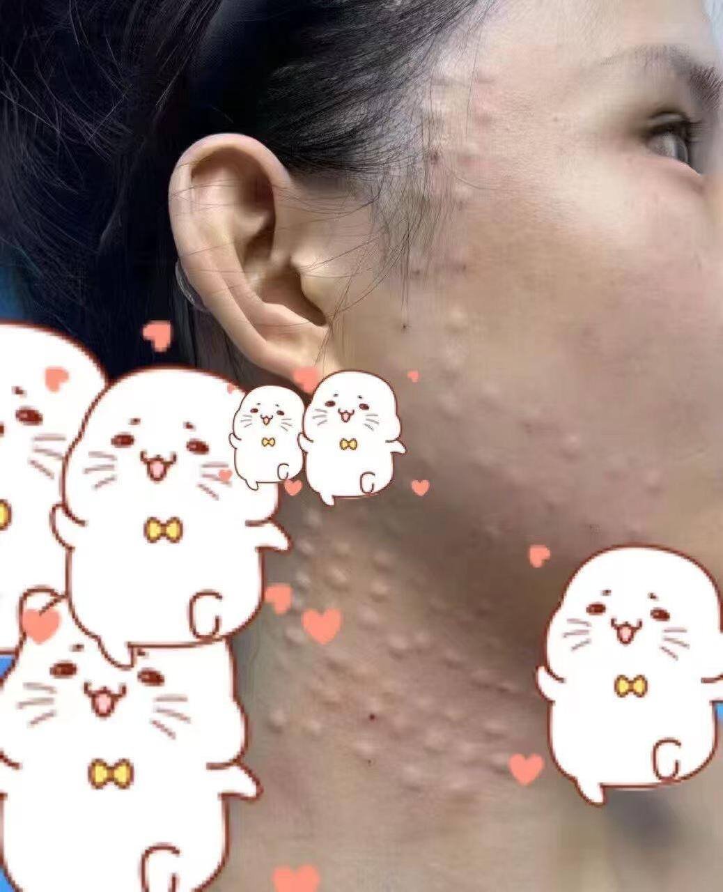 医美抗衰项目促销 选两项仅需$399