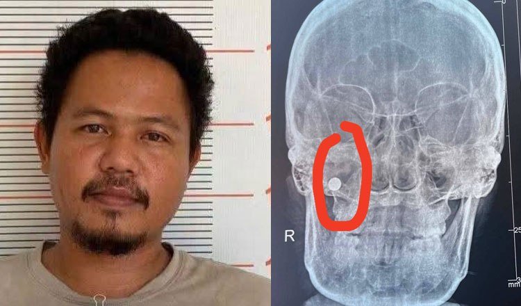 金边警方近日逮捕了一名涉嫌在一周前枪击女性面部的男子,案件目