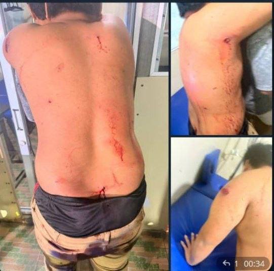 波贝发生自制炸弹袭击事件 警方介入调查