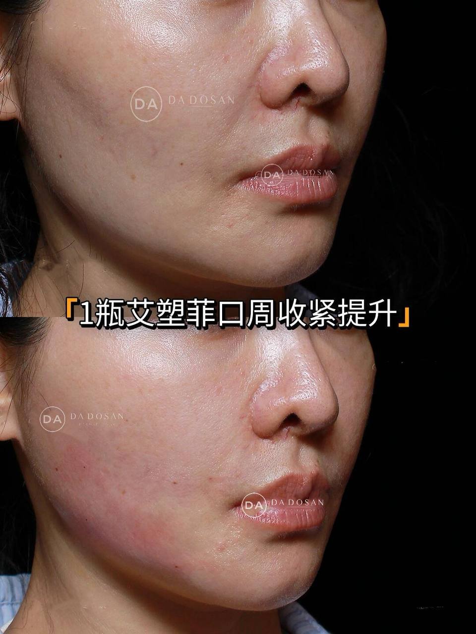 艾塑菲医美提供轮廓紧致与胶原激活服务