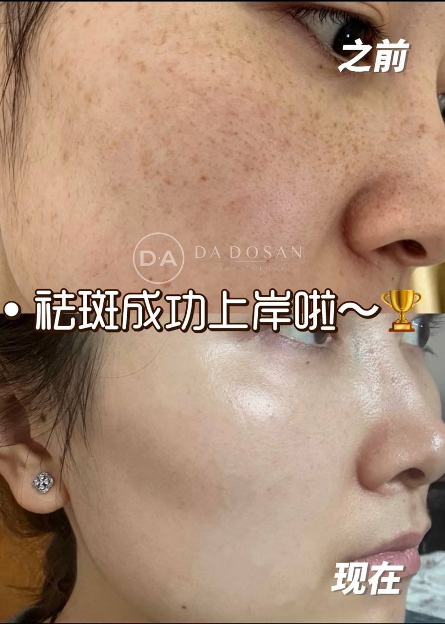 全球连锁美容祛斑服务 24小时在线咨询