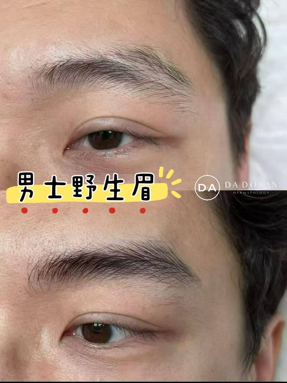 跨国连锁纹眉服务 柬埔寨等多国设有分店 24小时咨询