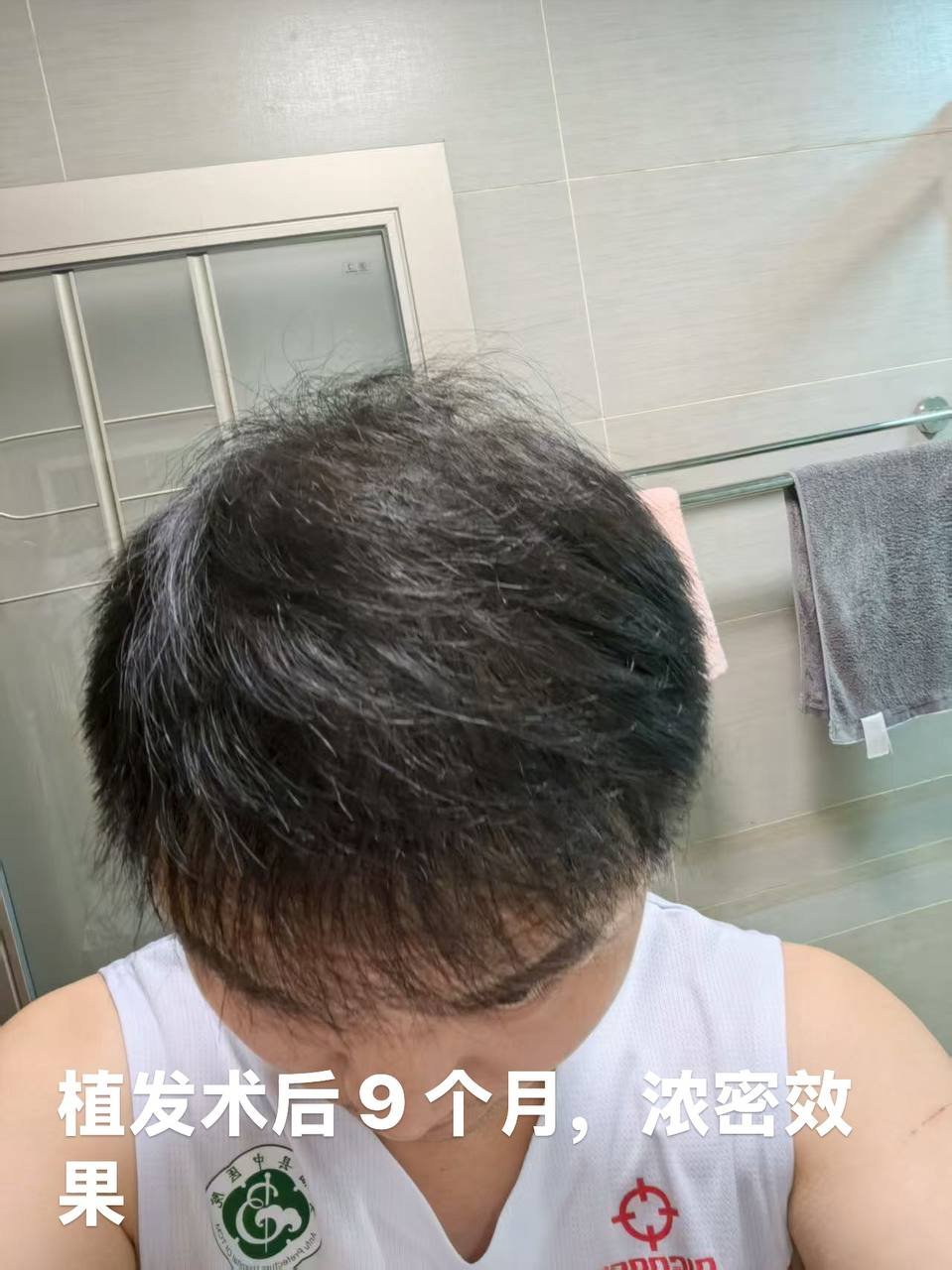 跨国医美连锁提供植发及牙齿贴面服务