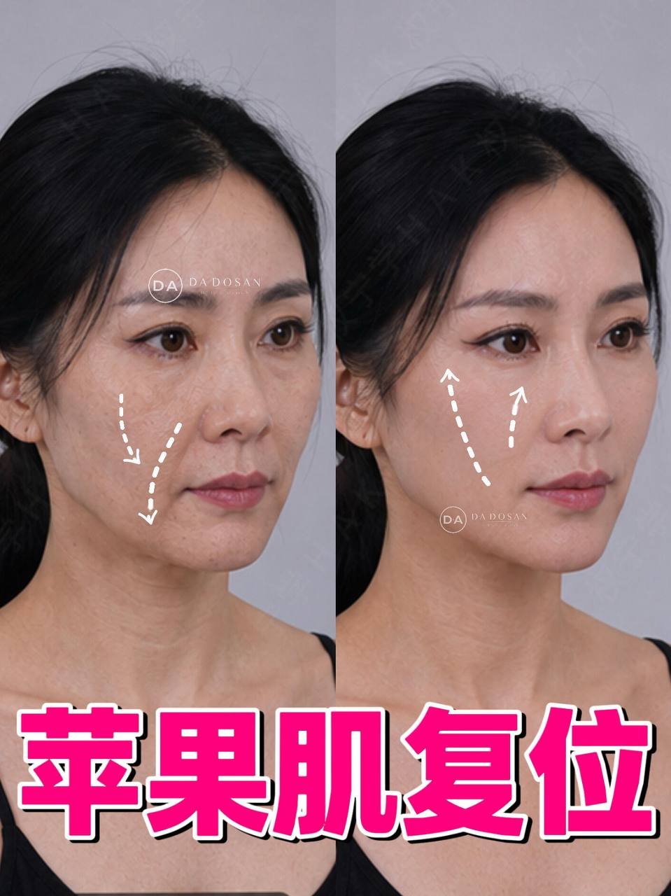跨国医美连锁提供植发及牙齿贴面服务