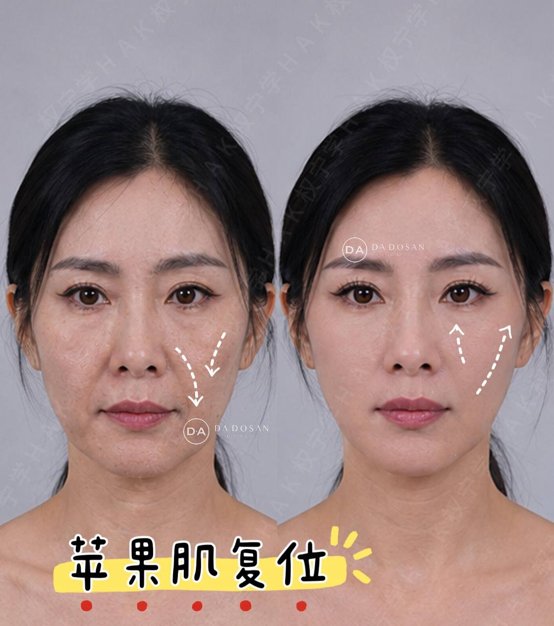 跨国医美连锁提供植发及牙齿贴面服务