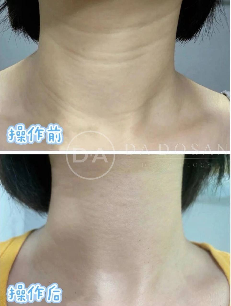 东南亚连锁医美机构提供多项美容及抗衰服务
