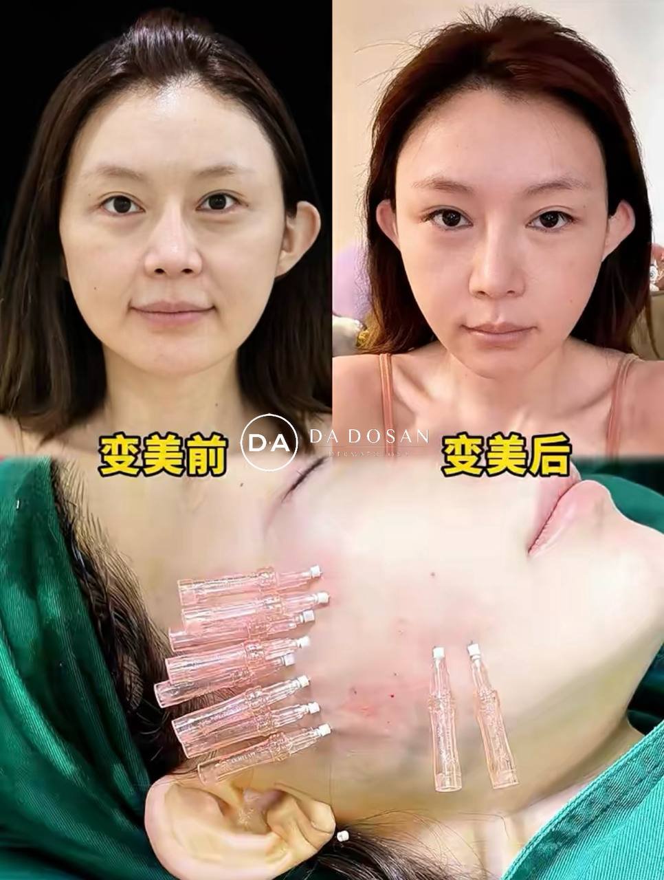 东南亚医美10年老店双11全项目特价 多国连锁