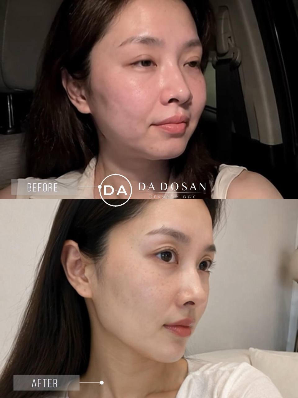 东南亚医美连锁十年老店 抗衰针剂光电 多国设分院