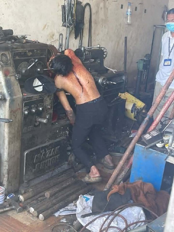 上丁省发生工业事故 一名男子被卷入车床