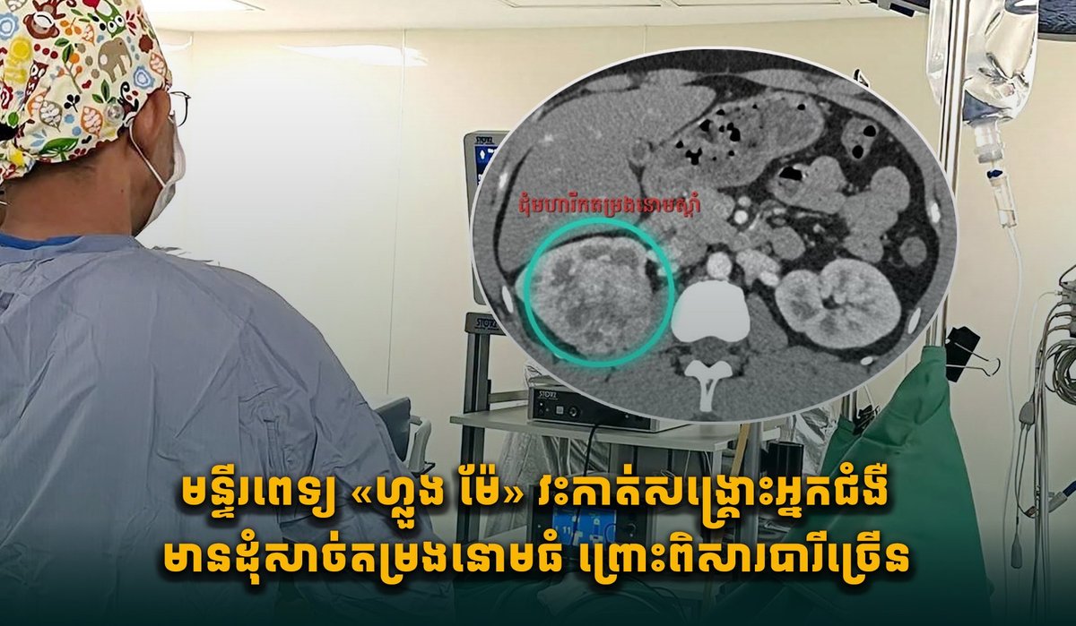 金边36岁男子因长期吸烟致肾肿瘤 隆美医院手术成功